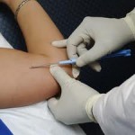 dogum_kontrol_implant-150x150